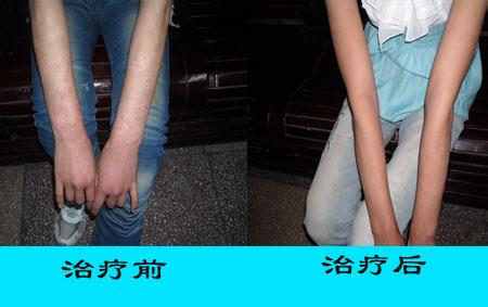 u=212080453,3885534180&fm=23&gp=0.jpg